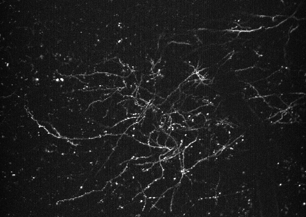 Image showing membrane potentials in distal dendrites at high spatial and temporal resolution