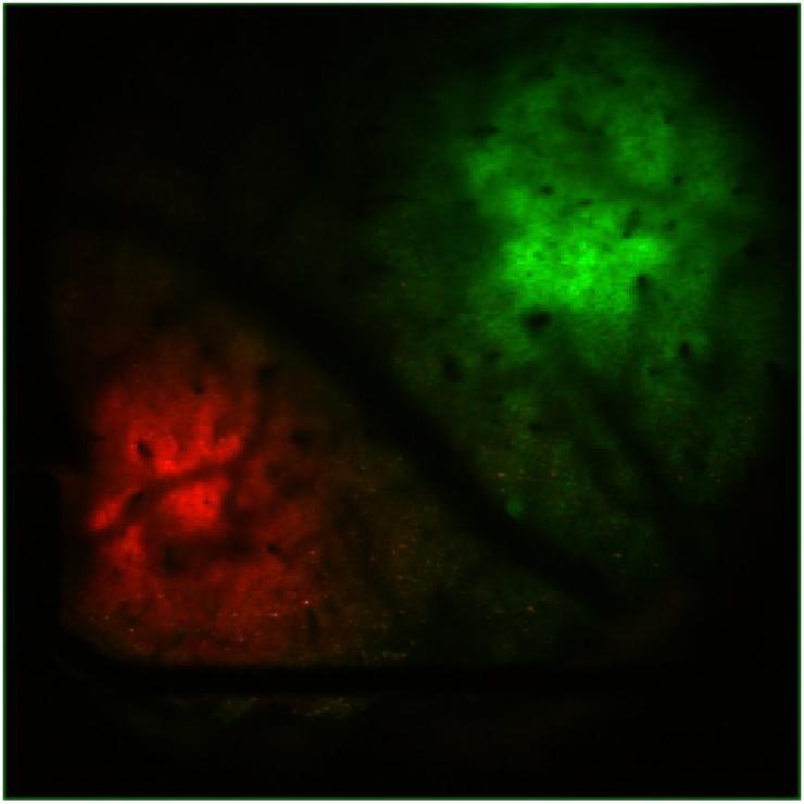 high-resolution fluorescence imaging in transgenic mice 