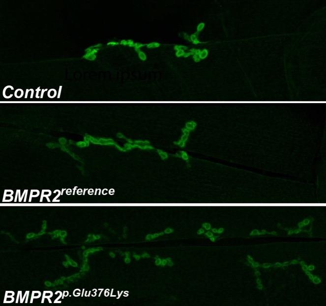 A rare variant in BMPR2 (p.Glu376Lys) found in individuals with neurodevelopmental conditions significantly increases the number of synapses in a fruit fly (Drosophila) model. Photo by Jung-Wan Mok.