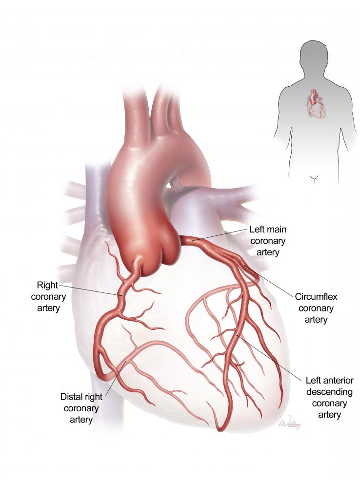 Coronary Artery Disease and Coronary Bypass Surgery