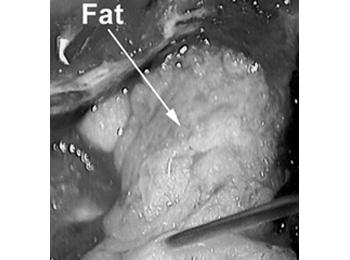 Figure 8: Fat