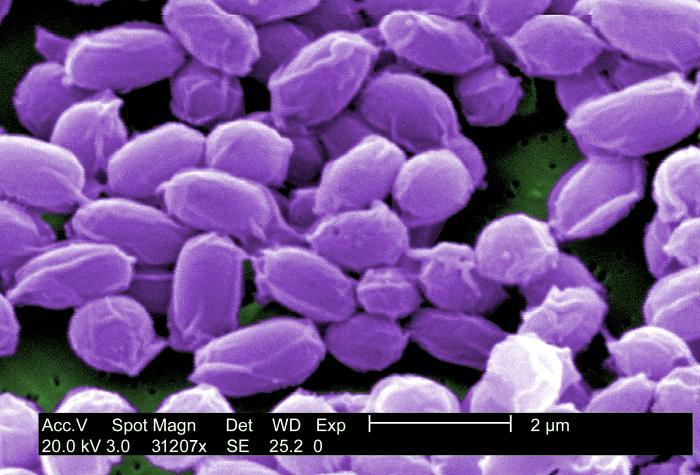 Potential Bioterrorism Agents