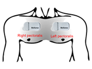 Chest Abduction Wearable Technology