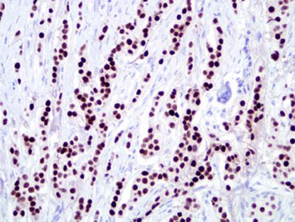 ER by IHC Stained Slide