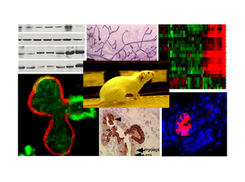Stem Cells, Wnt Signaling, and Breast Cancer