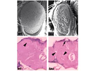 Compared to wild-type controls (left) expression of human Tau (right) in the Drosophila retina (top) or brain (bottom) leads to neurodegeneration.