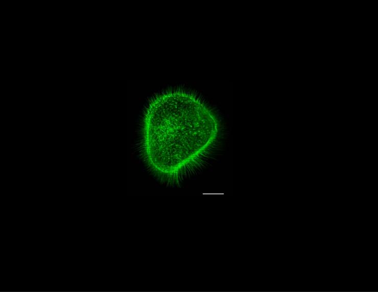 Cell-exhibits multiple filopodia. This cell was cultured from HNSCC-patient. The white par represents 10µm.
