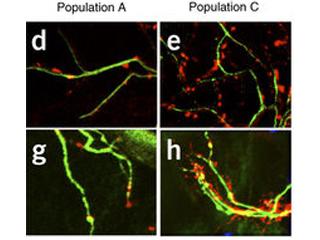 Identification of diverse astrocyte populations and their malignant analogs