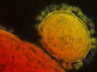 Transmission electron micrograph of Middle East Respiratory Syndrome Coronavirus