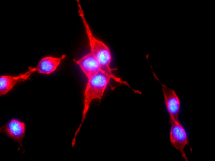 Fibroblast-like synoviocytes, cell types located inside most joints, are used by researchers to investigate rheumatoid arthritis.