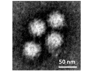 Human norovirus particles released into the supernatant of infected cultures and detected with electron microscopy. Courtesy of Estes Lab.