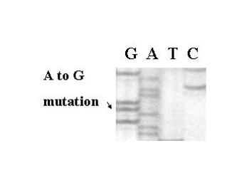 Estrogen Receptors in Breast Cancer Progression