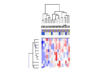 Prognosis of Breast Cancer