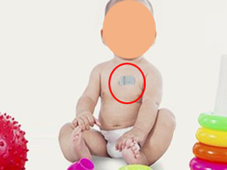 Using innovative wearables, we extract biomarkers of ASD