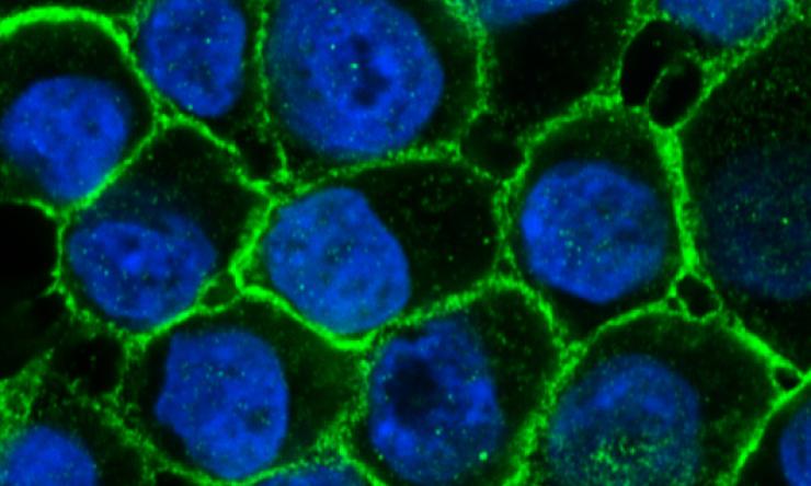 Human breast epithelial cells 
