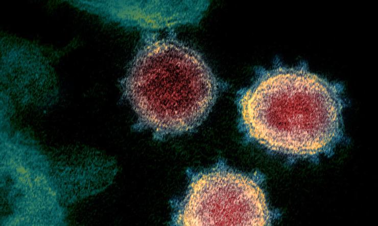 This transmission electron microscope image shows SARS-CoV-, also known as 2019-nCoV, the virus that causes COVID-19