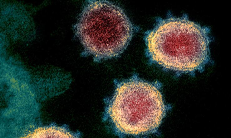 This transmission electron microscope image shows SARS-CoV-2—also known as 2019-nCoV, the virus that causes COVID-19—isolated from a patient in the U.S.