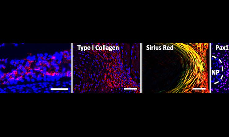 Growth Plate and Intervertebral Disc Development
