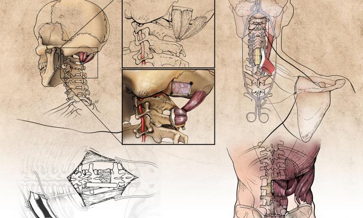 2020 Spino Plastics Illustration