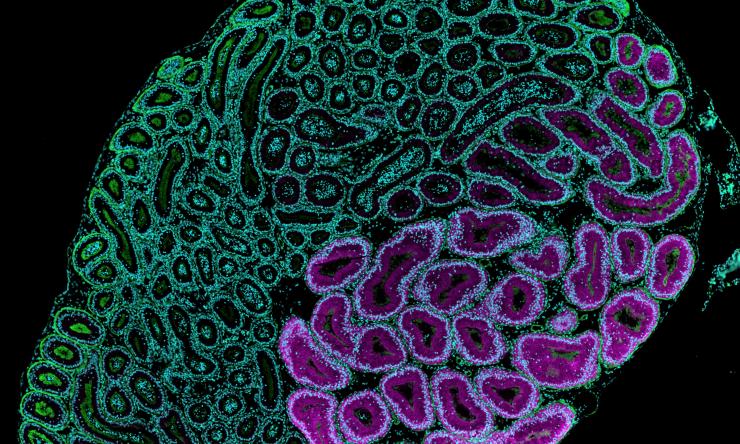 The proximal segment of the epididymis responds to the switch factor NELL2 and synthesizes OVCH2 (magenta), a protein indispensable for sperm maturation.