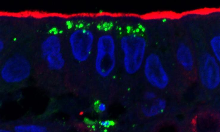 Intestinal organoids support replication of previously uncultivable enteric viruses. Image shows a human jejunal organoid monolayer infected with GII.4 norovirus. 