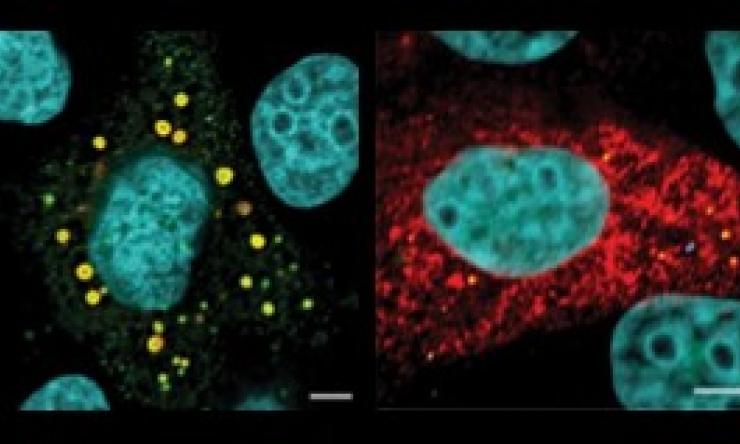Viroplasm