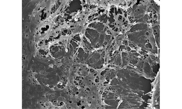 Scanning electron microscopy of extracellular matrix deposited in vitro by mouse cardiac fibroblasts