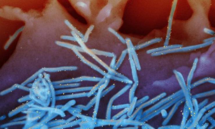 Scanning electron micrograph of human respiratory syncytial virus (RSV) virions and labeled with anti-RSV F protein/gold antibodies shedding from the surface of human lung epithelial A549 cells.