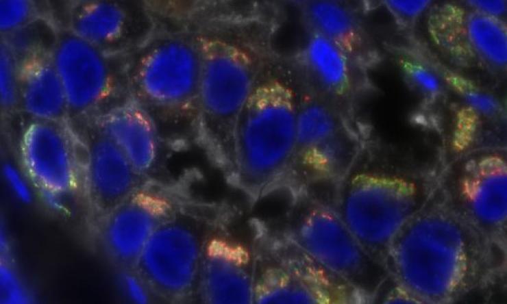 Wide field fluorescence microscopy of human triple-negative breast cancer