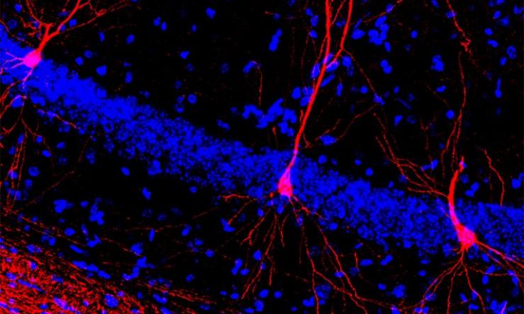 an image of early physical training of Rett mice, which results in the development of more dendritic arbors or cellular projections in a task-specific group of neurons in the hippocampus (red)
