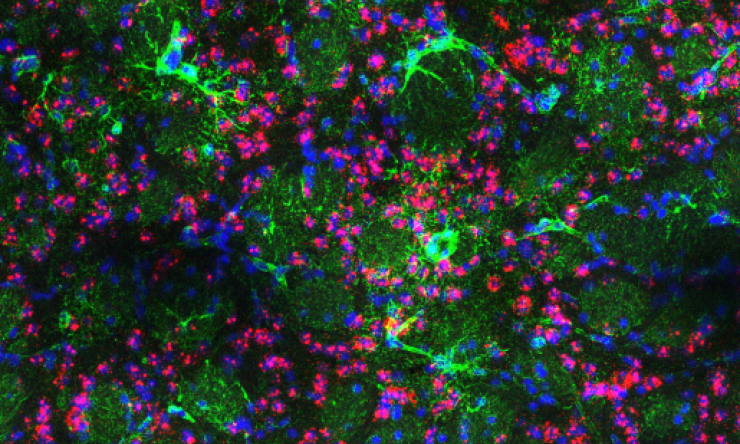 Brain of a mouse model of Huntington’s Disease
