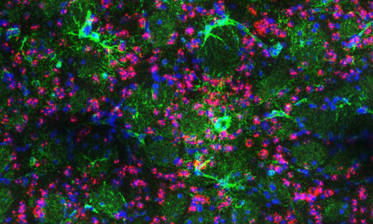 Brain of a mouse model of Huntington’s Disease