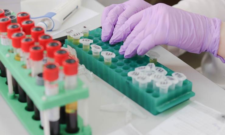 Close up of hands in a laboratory