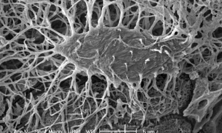 Osteocytes Bone Cells