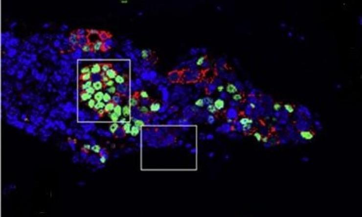 Immunofluorescence showing ER+ breast cancer cells (green) in mouse model