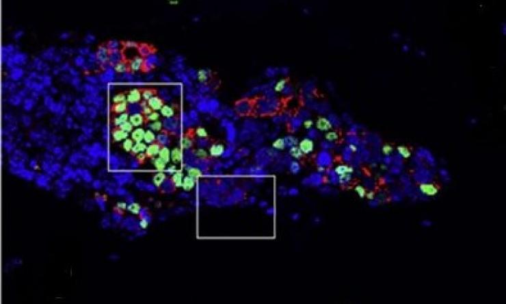 Immunofluorescence showing ER+ breast cancer cells (green) in mouse model
