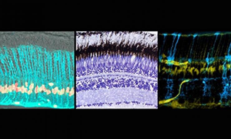 MGC Montage Poche Lab