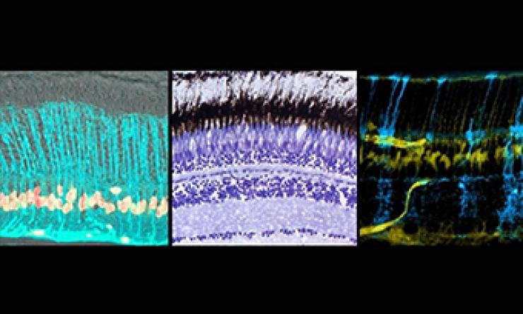 MGC Montage Poche Lab