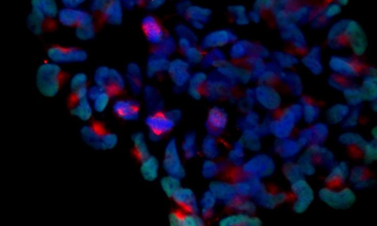 Neurosurgery Research Image