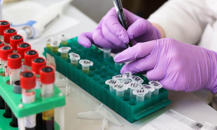Gloved hands working with test tubes in the lab