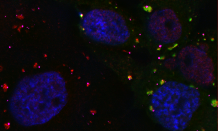 Microscopy Image of a Stress Granule Assembly