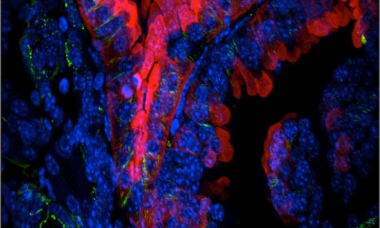 Frozen mouse kidney section stained to demonstrate a cystic kidney phenotype