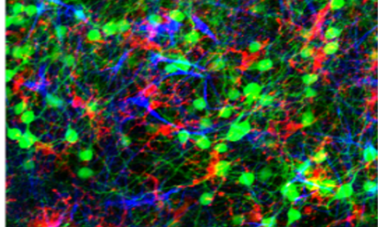 Microscopy image of brain cells