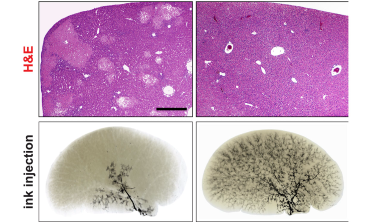 Treatment with anti-Poglut1 ASO significantly improves liver damage in a mouse model of Alagille syndrome