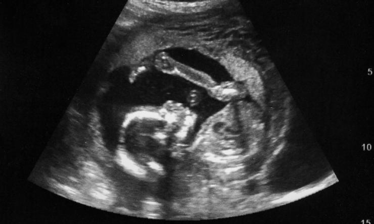 Ultrasound Fellowship Page