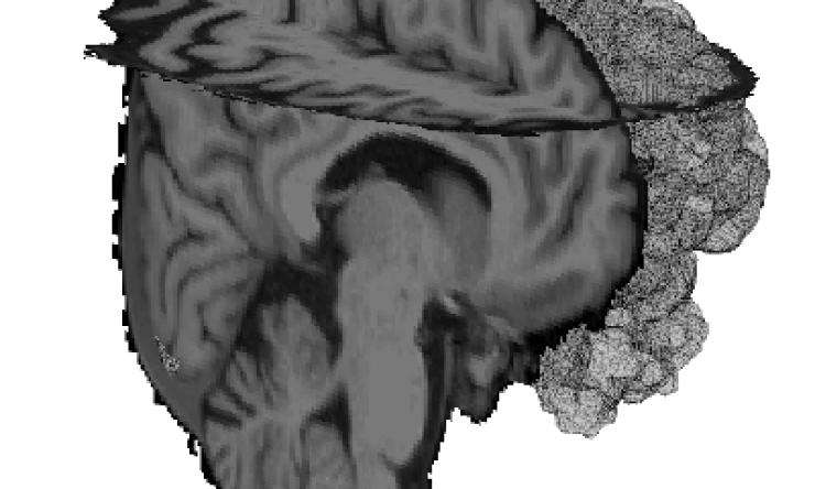 brain scan image