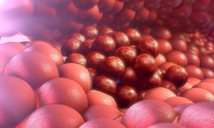 Closed up illustration of cancer cells