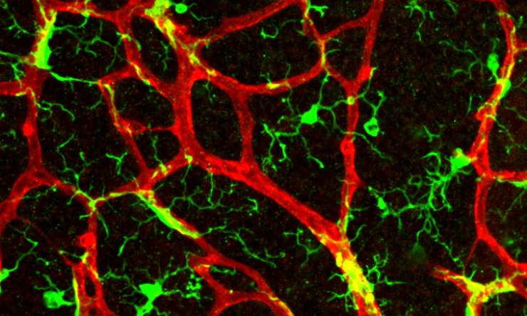 mouse retina vasculature and microglia confocal image