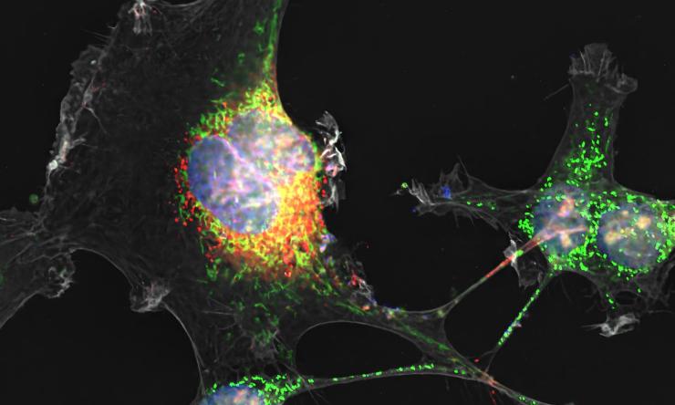 Zika virus's non-structural protein NS1 (red) and mitochondria (green) travel through the tunneling nanotube (TNT, gray) from infected to uninfected placental cells. 