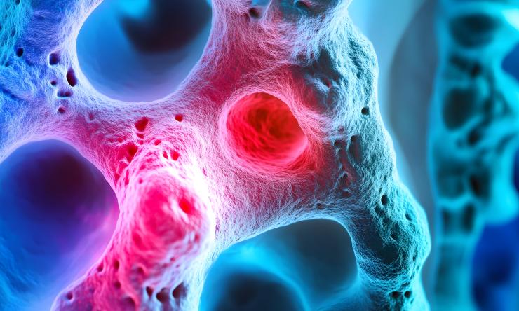 artistic rendering of bone denswity